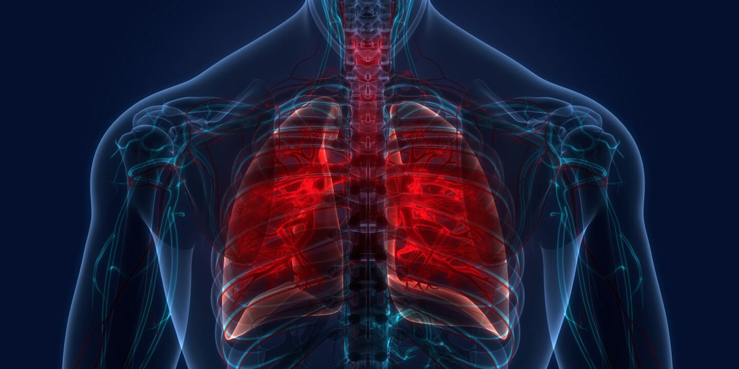 TB infected incur huge costs, despite free diagnosis, treatment under national program: Study